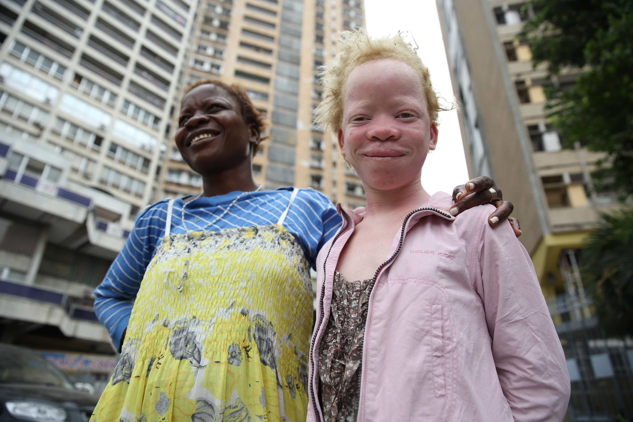 UN Women Fight for the Right of People Living With Albinism