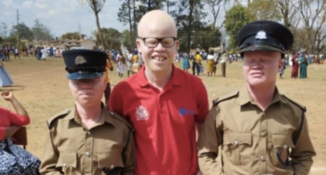 Two Malawian Albinos break jinx, Join Police Service